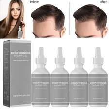 5 Pcs Deoxyribose Sugar Gel Hair Growth, Deoxyribose Serum for Hair Loss 60ml