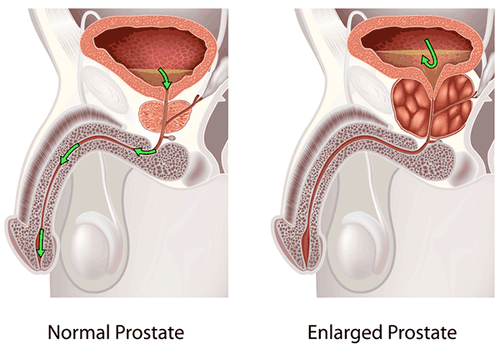 Maintain Healthy Urinary Tract - Prostate Support 1345mg - Pygeum Africanum 2B - Picture 3 of 12