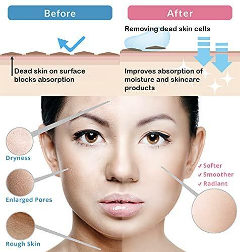 Toyo - Cure Aqua Gel - Facial/Full-body Peeling Gel, Water-based Exfoliator, - Picture 5 of 7