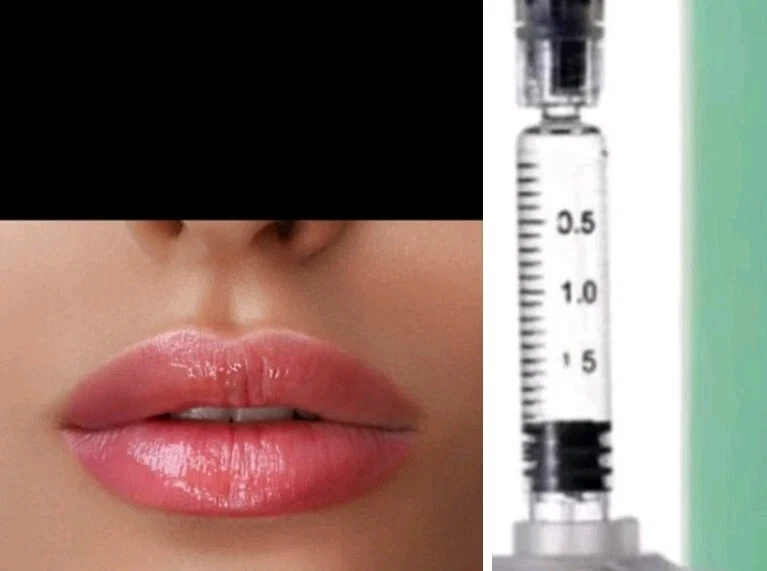 Hyaluronic*Acld Filler*/Hyaluronic Acid/*Yaluronic Acid/Face/Lip/Face/5x2ml
Opens in a new window or