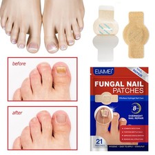 Anti Fungal Nail Treatment ELAIME Fungal Nail Patches Nail Care Toe NailSticker 