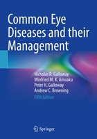 Nicholas R. Galloway (U. A.) | Common Eye Diseases And Their Management | Buch