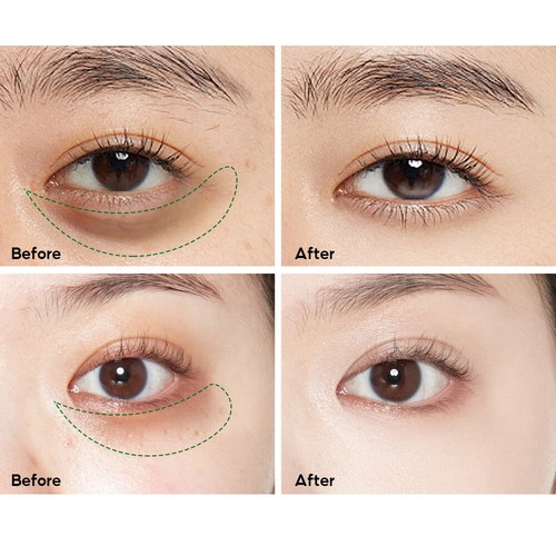 Magic Eye Cream-28 Seconds Instant Remove Eye Bags&dark Circles&eye Wrinkles 20g - Picture 2 of 24