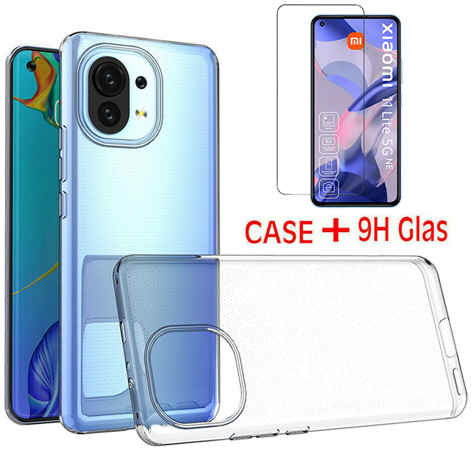 XINYEXIN Custodia Per Xiaomi Mi 11 Lite 4G/5G/5G NE – Cover IMD Con Design Glitter E Marmo, Morbida TPU Antiurto, Bordi Rialzati, Ricarica Wireless, Regalo Donna