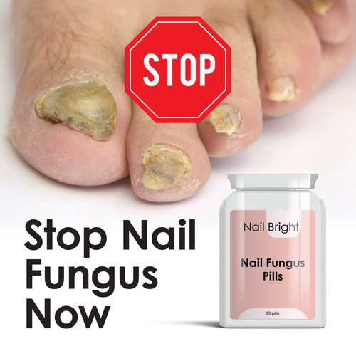 NAIL BRIGHT PILLS NAIL FUNGAL CURE STOP FUNGUS DRY BRITTLE CRUMBING