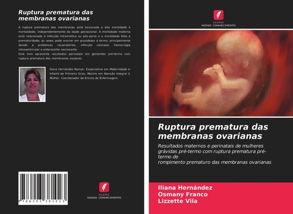 Iliana HernáNdez (U. A.) | Ruptura Prematura Das Membranas Ovarianas | Buch-image