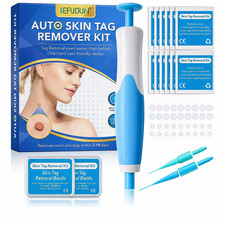 Auto Micro Skin Tag Remover Device Kit Safe Painless Removal 2-8 mm Band Tool