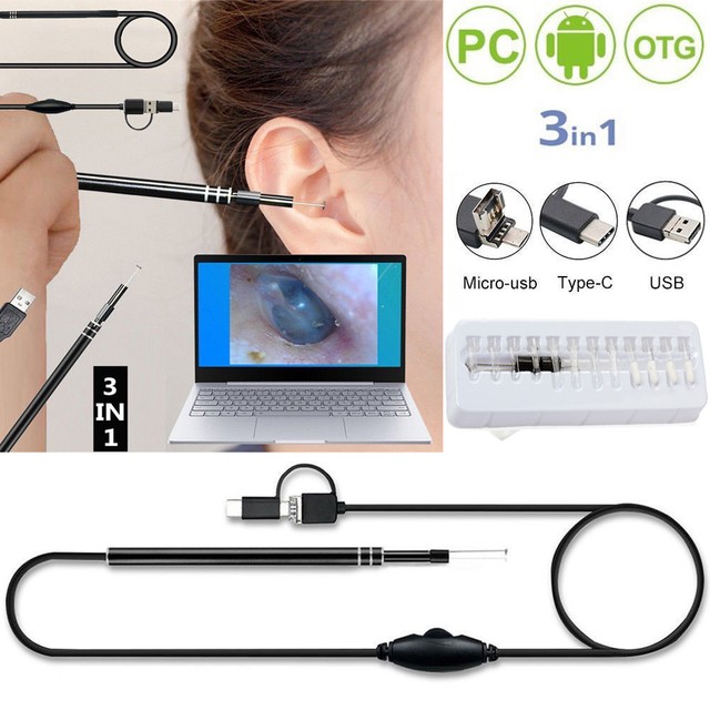 3in1 Pro HD Ear Scoop Endoscope Set Ear Wax Cleaner Otoscope Camera 1