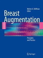 Melvin A. Shiffman | Breast Augmentation | Taschenbuch | Englisch (2010)