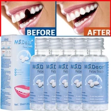 Tooth Repair Granules Temporary Kit Fitting Beads Reusable Moldable False Teeth~