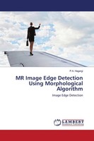 P. A. Hagargi | Mr Image Edge Detection Using Morphological Algorithm | Buch