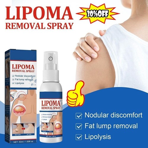 50ml Lipomheilung Reduction Spray, Instant LumpFree best Lipoma Removal E2Y8 - Picture 2 of 17