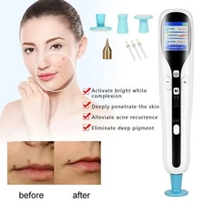 2 IN 1 Ozone Plasma Pen Skin Mole Dark Spot Remover Face Lifting Fibroblast Pen