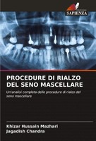 Khizar Hussain Mazhari (U. A.) | Procedure Di Rialzo Del Seno Mascellare | Buch