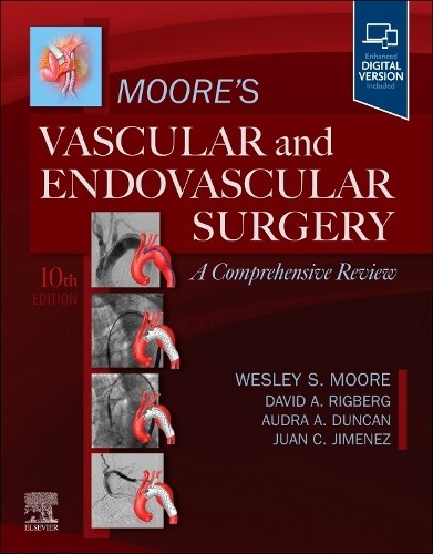 Moore's Vascular and Endovascular Surgery: A Comprehensive Re... - 9780443284328