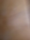 Foto 11 di 11