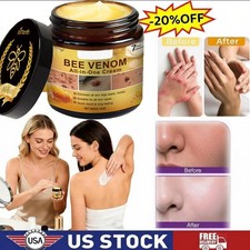 Bee Venom Skin Restoration Cream, Professional Bee Venom Skin Treatment Cream US