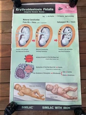 VINTAGE 1962 SIMILAC NURSING POSTER ERYTHROBLASTOSIS FETAILS ROSS LABORATORIES