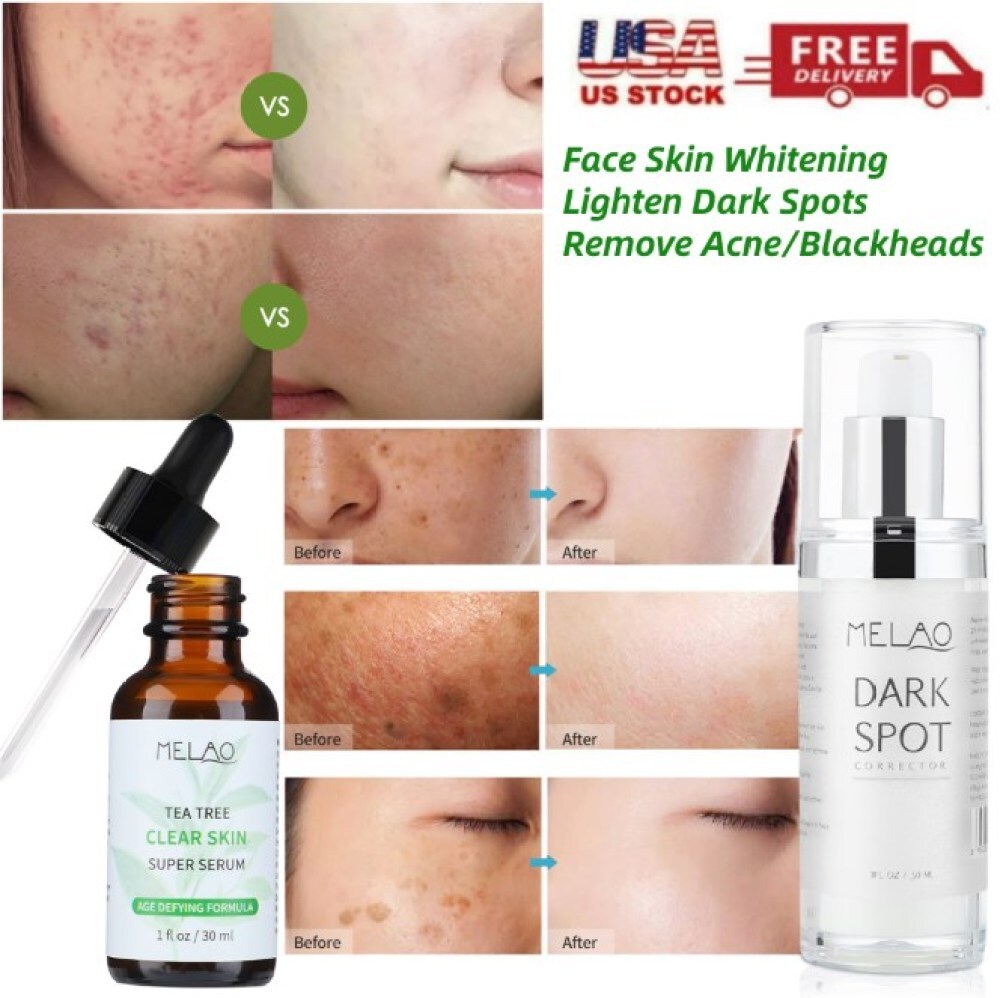 Tea Tree Oil Acne Before And After