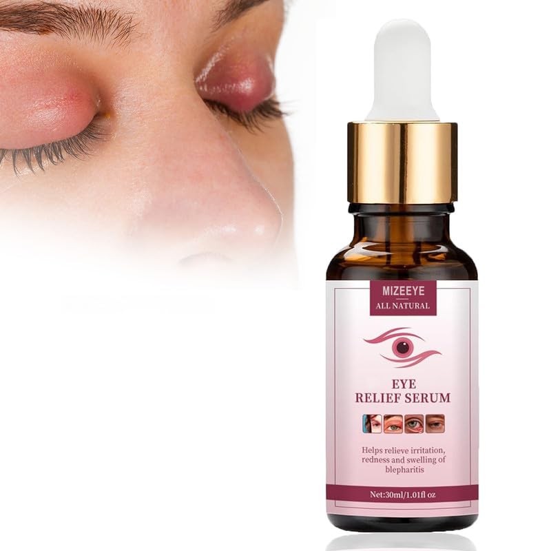 Eye Relief Serum for Styes, Blepharitis, Chalazion, Dark Circles, Puffiness 30ml
