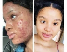 2 x Skin Lightening Cream Extra Strength Lighter FAST Result-NO SIDE EFFECTS