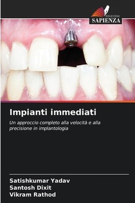 Impianti immediati by Satishkumar Yadav (Italian) Paperback Book