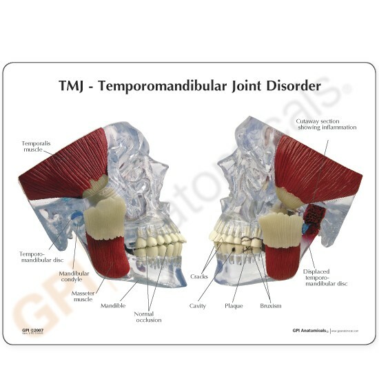 TMJ - Giunto temporo-mandibolare modello anatomico GPI LFA #2880 VIDEO Fai un'offerta! foto 3