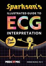 Sparksons Illustrated Guide to ECG Interpreta...