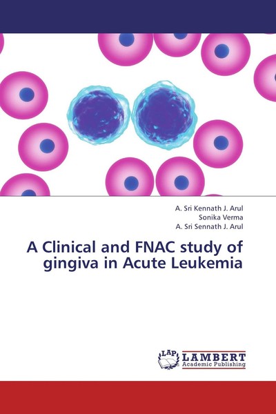 A Clinical And Fnac Study Of Gingiva In Acute Leukemia A. Sri Kennath J. Arul-image