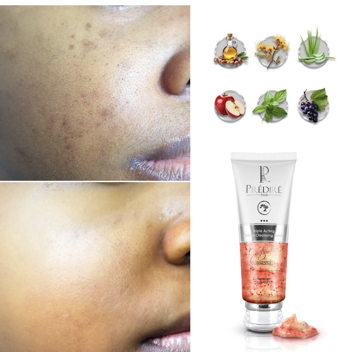 Exfoliante de limpieza facial de triple acción Predire Paris colágeno y retina $115