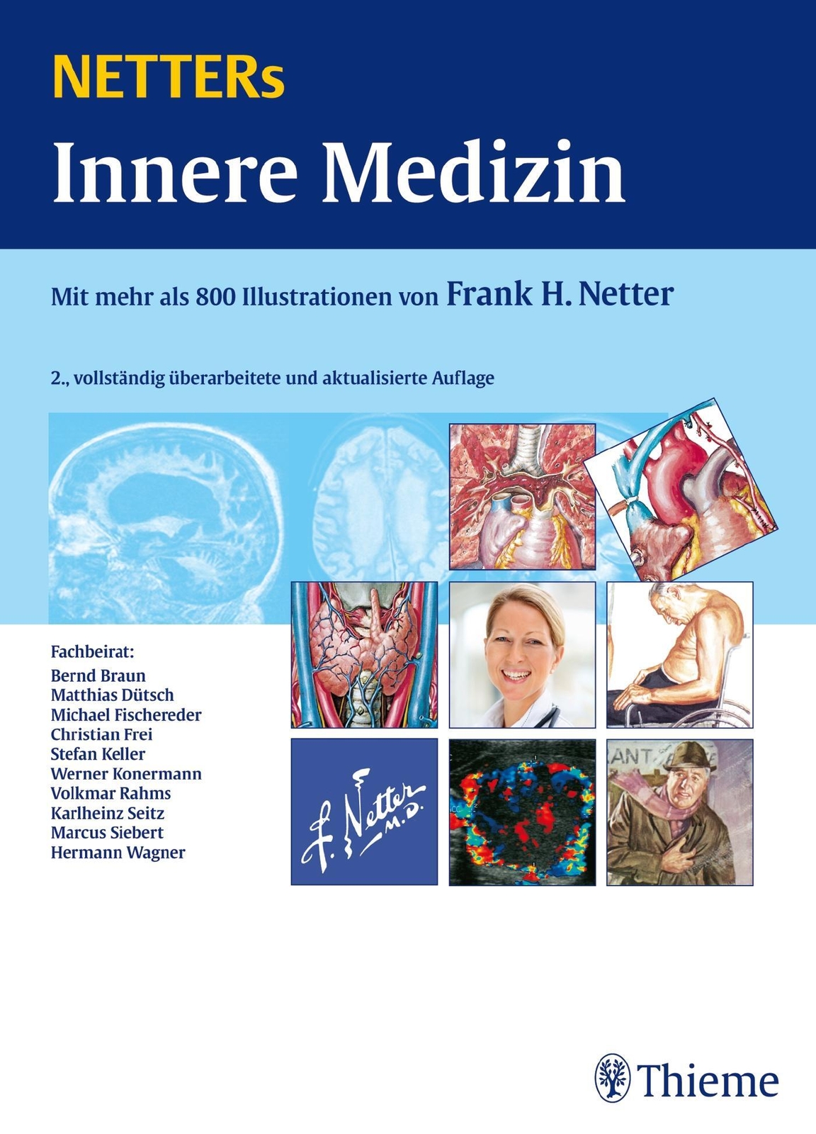 Thumbnail - Netters Innere Medizin | Frank H. Netter | Buch | Gebunden (fh) | 841