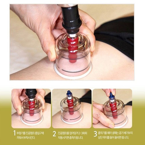 Hansol 19 Cups Cupping Set Slimming Massage Vacuum Therapy Pump Acupuncture - Picture 4 of 8