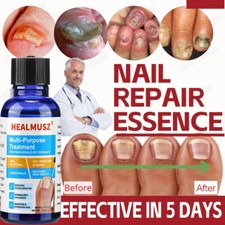 Nail Care Antibacterial Fungal Nail Treatment Nail Repair Essential Oil Serum