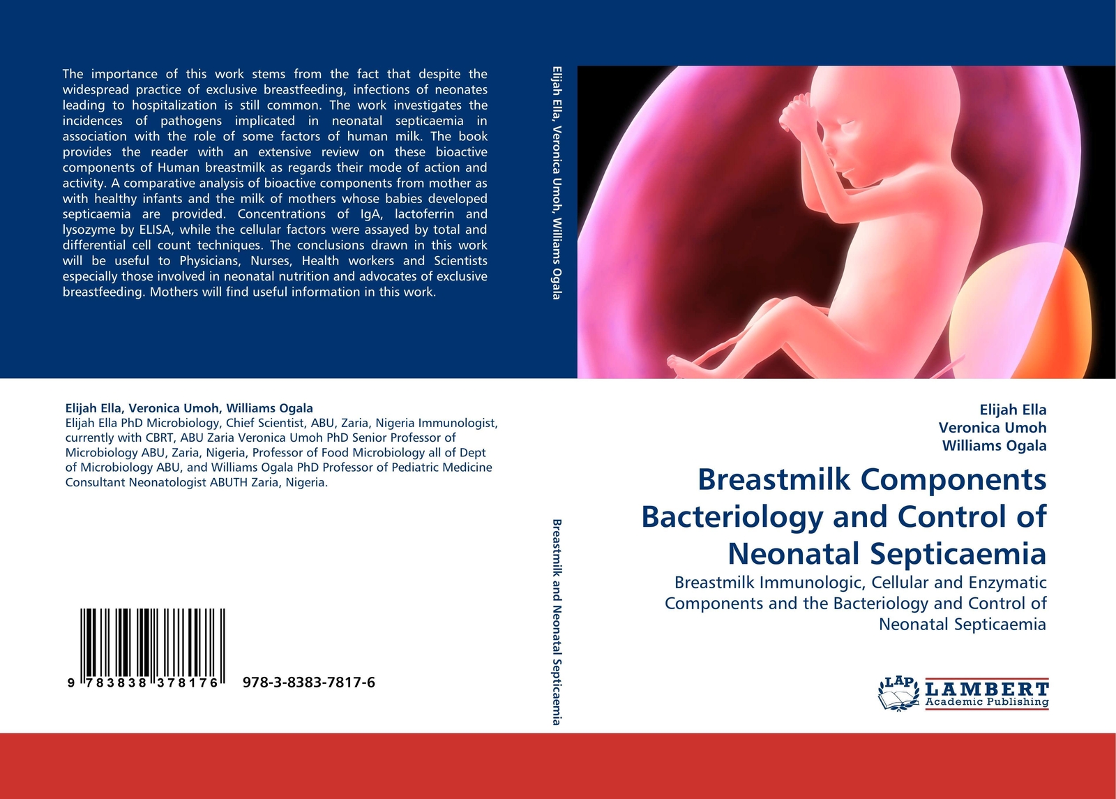 Breastmilk Components Bacteriology And Control Of Neonatal Septicaemia