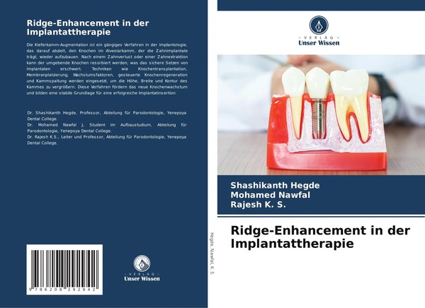 Shashikanth Hegde (U. A.) | Ridge-Enhancement In Der Implantattherapie | Buch-image