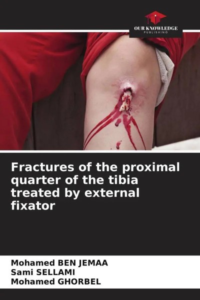 Mohamed Ben Jemaa (U. A.) | Fractures Of The Proximal Quarter Of The Tibia...-image