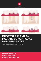 Manoj Kumar (U. A.) | PrÓTeses MAXILO-FACIAIS Suportadas Por Implantes | Buch