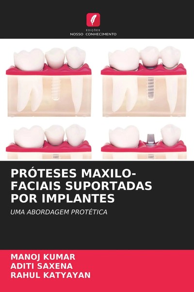 Manoj Kumar (U. A.) | PrÓTeses MAXILO-FACIAIS Suportadas Por Implantes | Buch-image