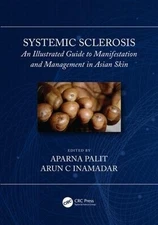 Systemic Sclerosis - 9781138480049