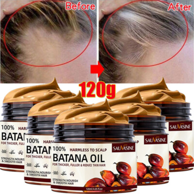 5~Batana Oil Conditioner for Hair Growth,Anti Hair Loss,Healthier Thicker Fuller