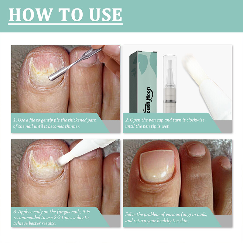 Anti Fungal Nail Treatment Repair Finger Toe Care Nail Fungus Liquid