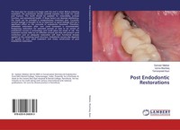 Sameer Makkar (U. A.) | Post Endodontic Restorations | Taschenbuch | Englisch