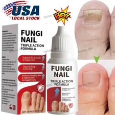 Fungi-Nail Anti-Fungal Liquid Solution Kills Fungus That Can Lead To Nail