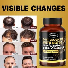 Bloqueador DHT - biotina, palma enana americana, semilla de calabaza, salud de la próstata, reducción de la pérdida de cabello