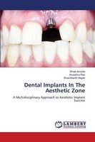 Dental Implants In The Aesthetic Zone Shaik Amrulla