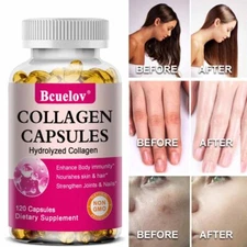 High Strength Collagen Caps Enhance Immunity Strengthen Joints Nails 30-120 Ct