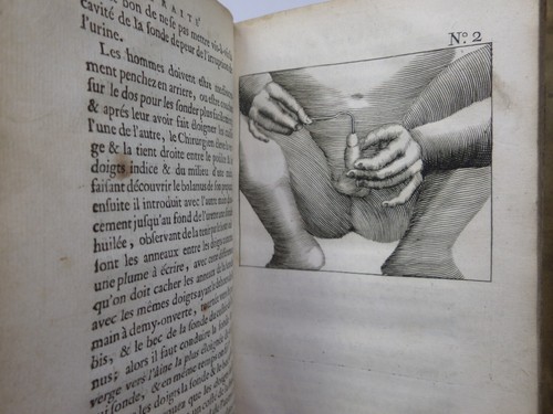TRAITE DE LA LITHOTOMIE OU DE L'EXTRACTION DE LA PIERRE HORS DE LA VESSIE 1686 - 第 12/24 張圖片
