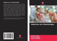Adesivos Em Odontologia Shefali Dogra