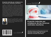 ErupcióN Inducida Por Ortodoncia De Los Incisivos Centrales Maxilares Daniela Go