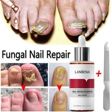 LANBENA Antibacterial Fungal Nail Treatment Nail Repair Essential Oil Serum